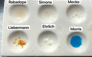 Faux positifs des tests de cocaïne