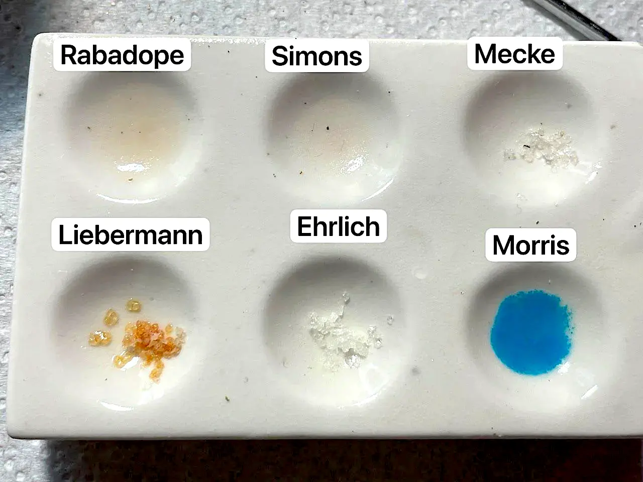 Faux positifs des tests de cocaïne