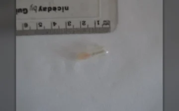 Comprimés Galenika Rivotril (Clonazepam)