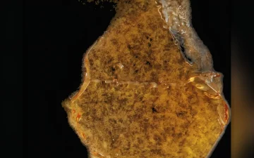 Huile de cannabis delta-8