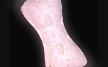 Comprimés Gleich Wie Vorderseite (Ecstasy / MDMA)